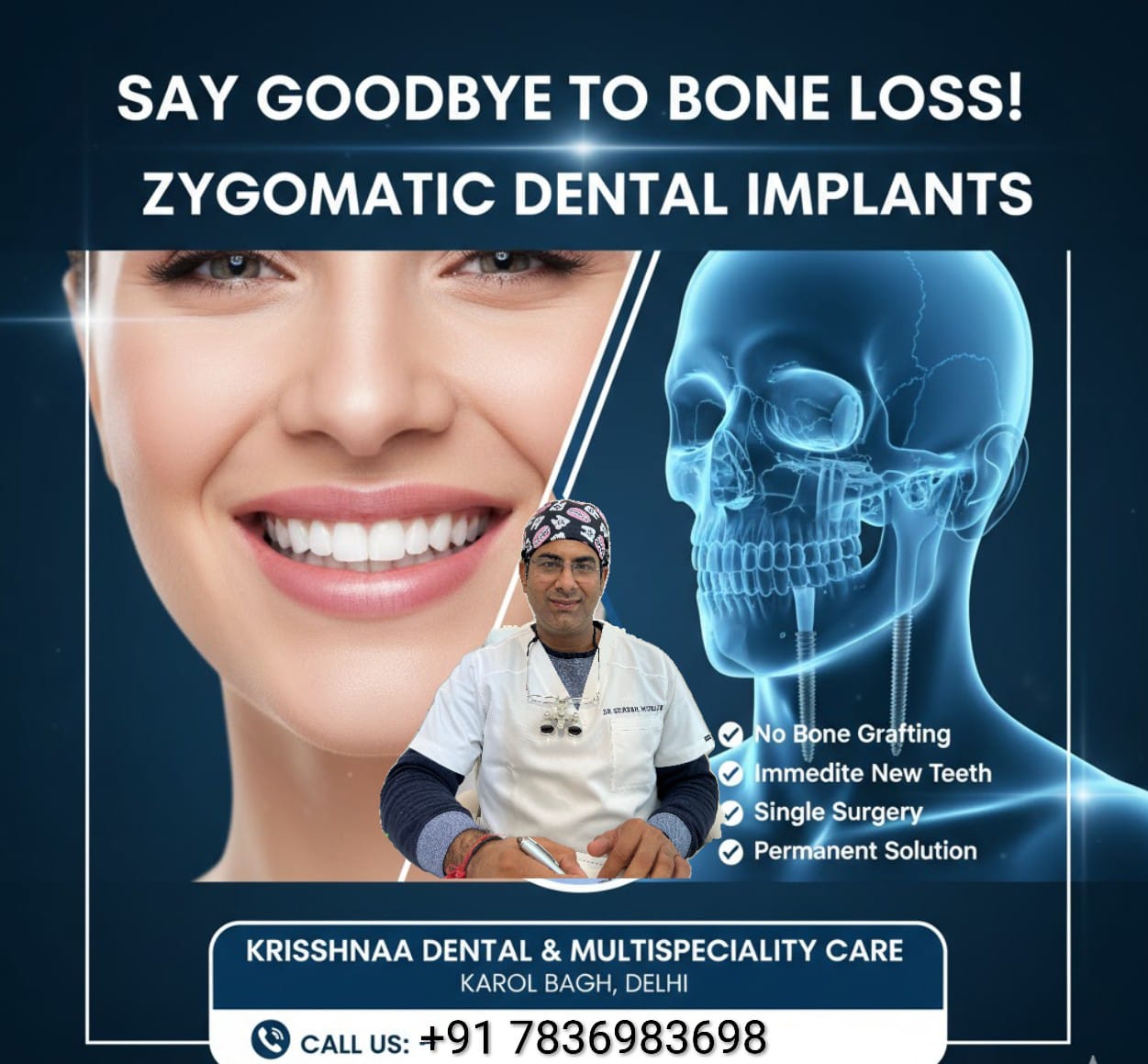 Zygomatic Dental Implants in Karol Bagh, Delhi  KRISSHNAA Dental  Multispeciality Care