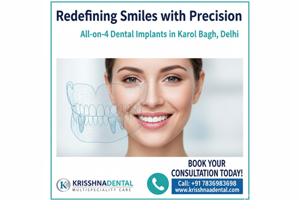 Allon4 Dental Implants in Delhi  Krisshnaa Dental Karol Bagh