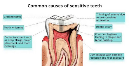 9 things you probably did not know about dental fillings