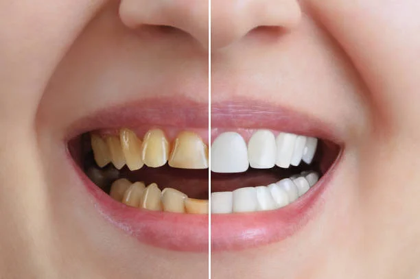 Cosmetic Dentistry Smile Treatment