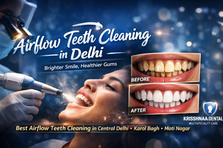Airflow Teeth Cleaning in Delhi at Krisshnaa Dental showing advanced stain removal procedure with before and after results, offering best airflow teeth cleaning in Central Delhi, Karol Bagh and Moti Nagar Delhi.