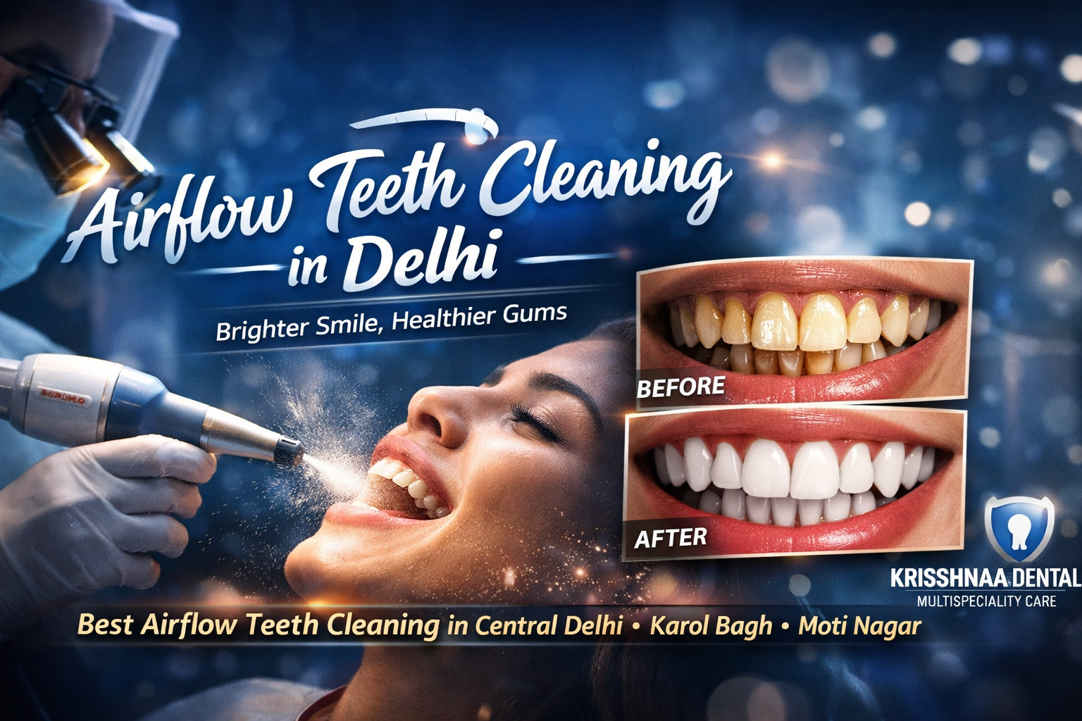 Why Airflow Teeth Cleaning Is the Best Choice for a Healthier, Brighter Smile
