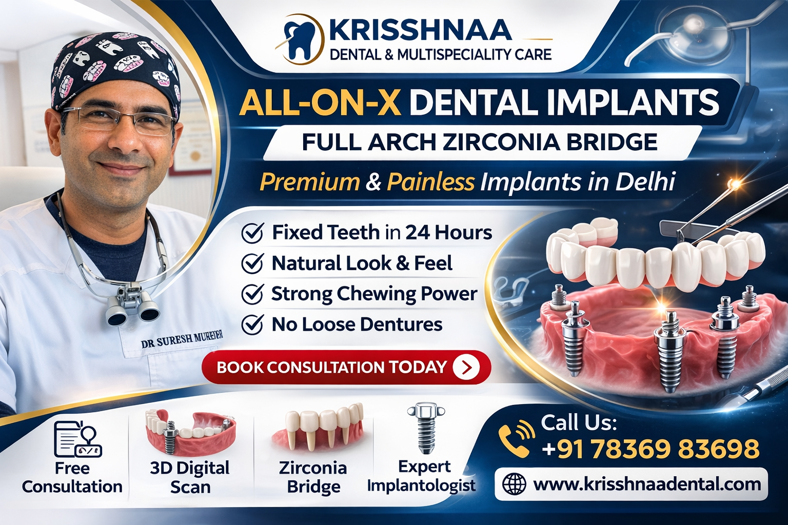 All-on-X Fixed Hybrid Dental Implants in Delhi