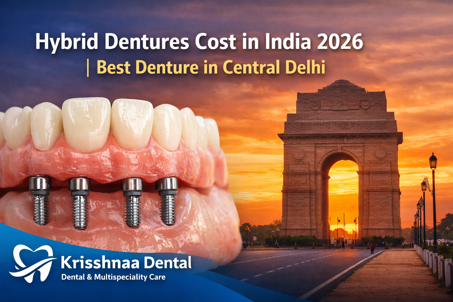 Hybrid Dentures Cost in India 2026 | Complete Guide to Fixed and Implant Dentures