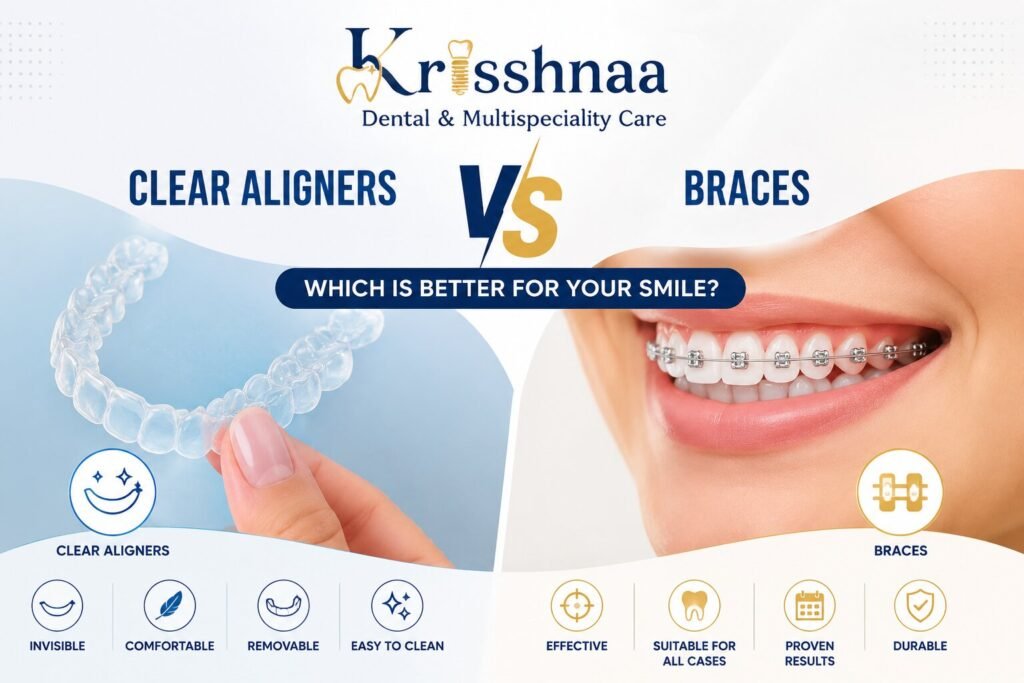 Braces and Aligners in Delhi