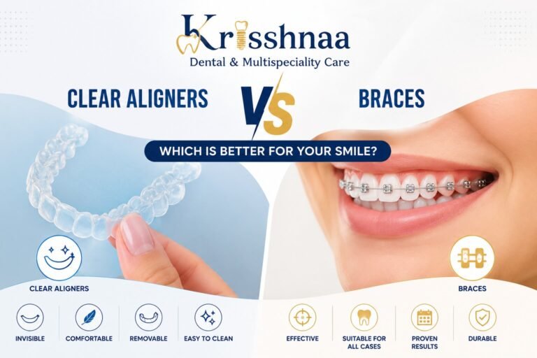 Braces and Aligners in Delhi