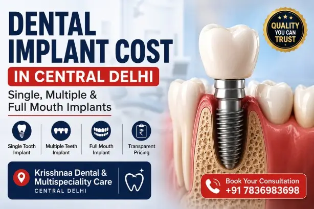 Dental implant cost in Central Delhi showing single tooth, multiple teeth and full mouth implant treatment at Krisshnaa Dental & Multispeciality Care