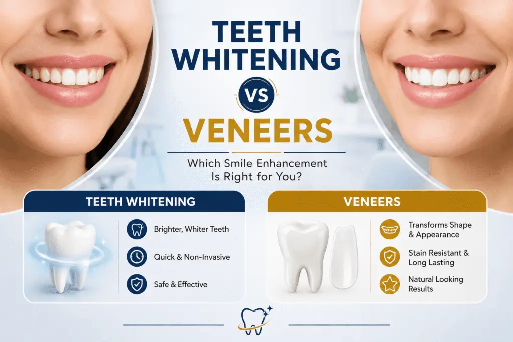 Teeth Whitening vs Veneers