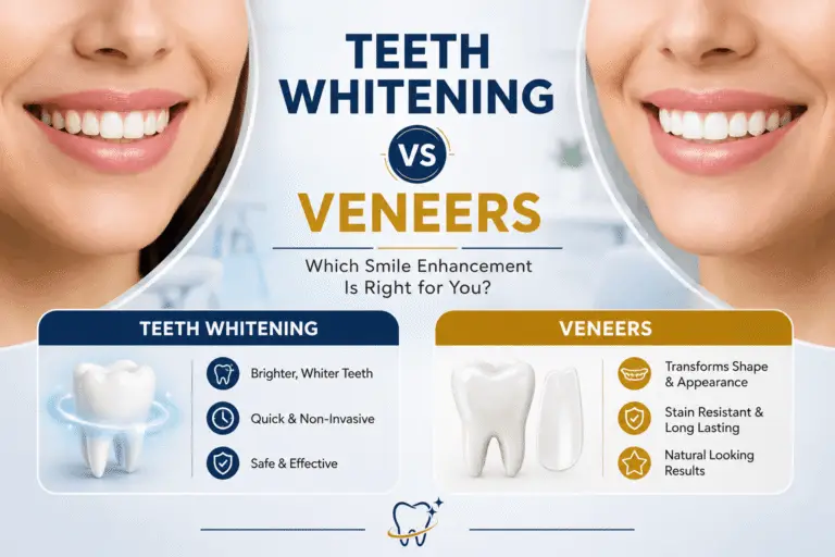 Teeth Whitening vs Veneers