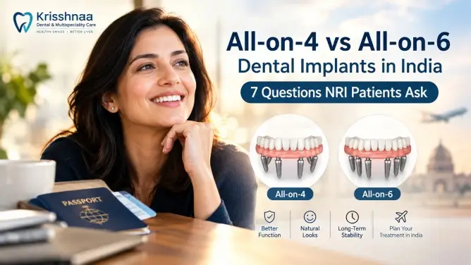 All-on-4 vs All-on-6 dental implants in India for NRI patients, explained by Krisshnaa Dental & Multispeciality Care in Central Delhi.