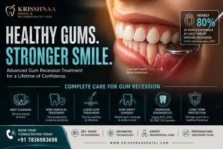 Patient receiving advanced gum recession treatment at Krisshnaa Dental & Multispeciality Care in Delhi with laser gum therapy and periodontal care for healthy gums and reduced sensitivity.