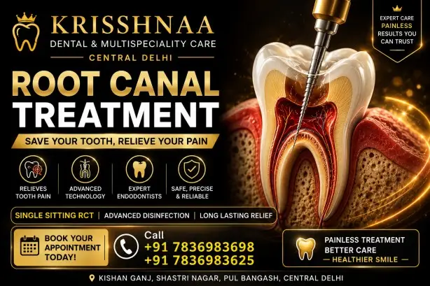 Advanced root canal treatment in Central Delhi at Krisshnaa Dental & Multispeciality Care for tooth pain and infected teeth