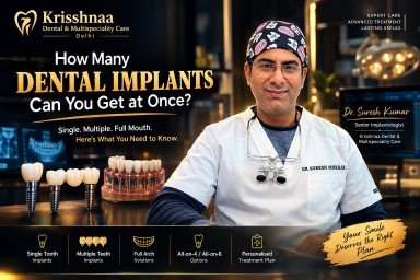 Dr. Suresh Kumar, implantologist at Krisshnaa Dental & Multispeciality Care, Delhi, explaining single, multiple and full-mouth dental implant treatment options.
