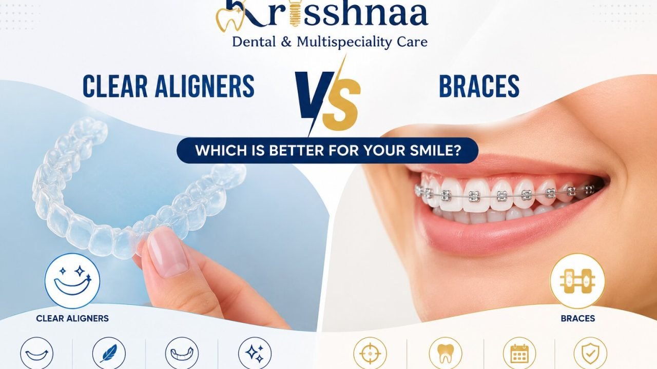 Braces and Aligners in Delhi