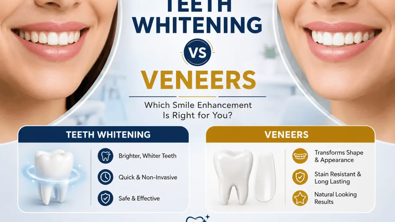 Teeth Whitening vs Veneers